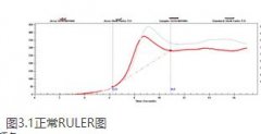 潤滑油檢測(cè)中抗氧化劑含量(RULER)是什么？